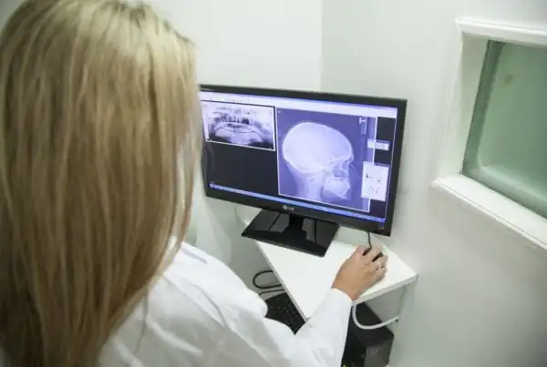 Roundup personal injury attorney